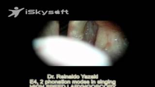 HighSpeed Laryngoscopy of singing: E4 in 2 different modes of phonation