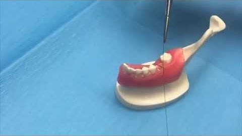 Extraction Socket Grafts and Suturing Recommendation