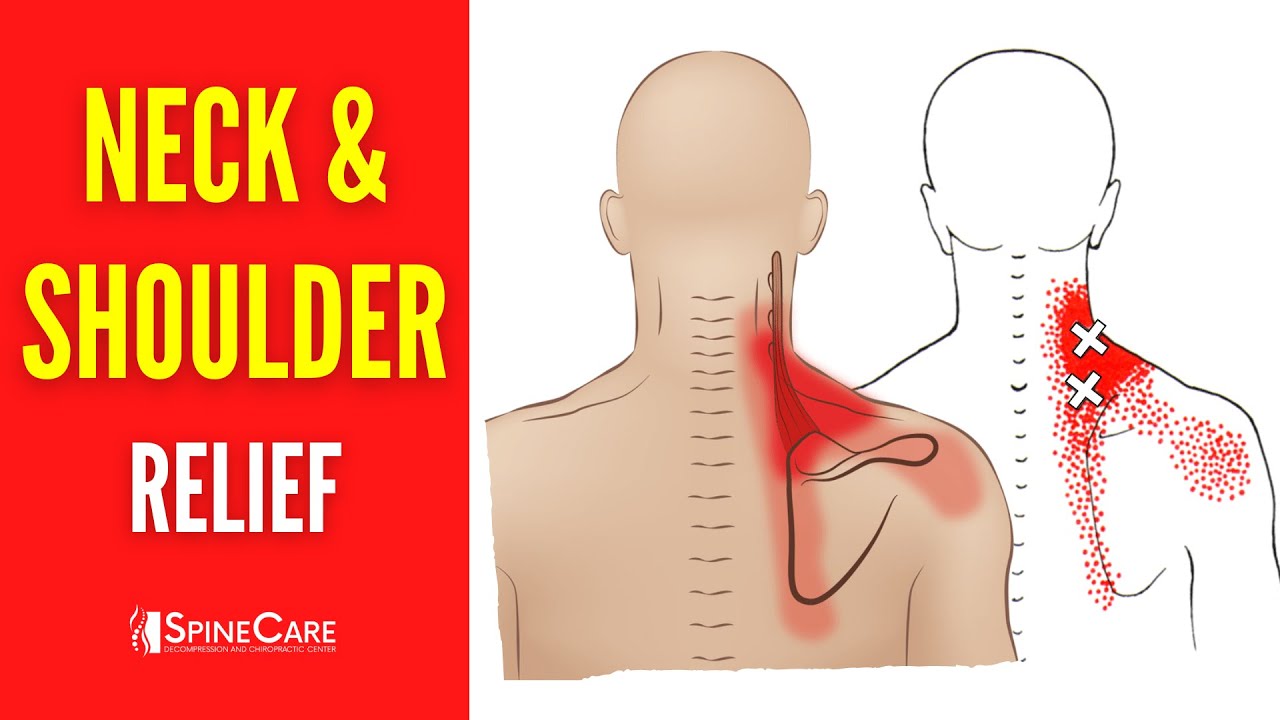 How to Fix Shoulder Pain FOR GOOD - YouTube