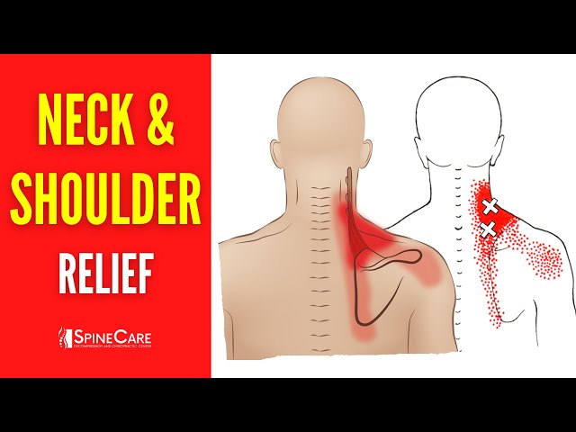 Physical therapy for neck and shoulder pain the vital role