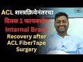 ACL शस्त्रक्रियेनंतरचा दिवस 1 फायबरटेप Internal brace, Recovery after ACL FiberTape Surgery #acl