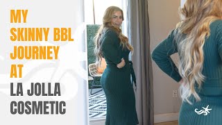 My Skinny BBL Experience: Why I Got It, Recovery, What To Expect