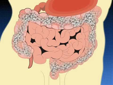 Салофальк - лекарственные формы, болезнь Крона, ВЗК © Salofalk - dosage forms, Crohn's disease, IBD