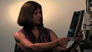 Atlantis Eyecare Cataract Patient Testimonials