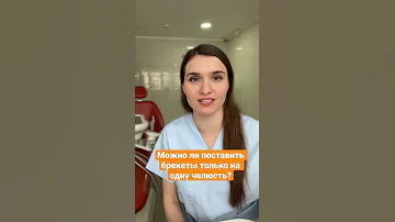 Можно ли поставить брекеты на одну челюсти?