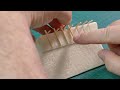Middle of video