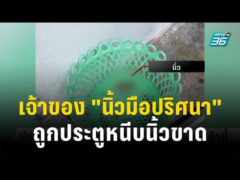 เจ้าของ "นิ้วมือปริศนา" เผย ถูกประตูหนีบนิ้วขาด | โชว์ข่าวเช้านี้ | 11 ต.ค.66