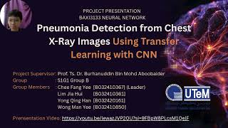 Neural Network | Pneumonia Detection from Chest X-Ray Using Transfer Learning with CNN