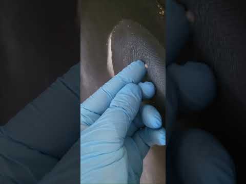 Vidéo — Bombe de froid anti insecte (-40°C) ICE BOMB