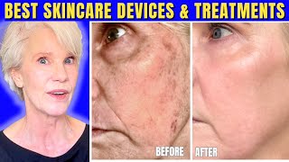 Best Skincare Treatments to Transform Mature Skin (Top 3 Devices & Top 3 InOffice Treatments)