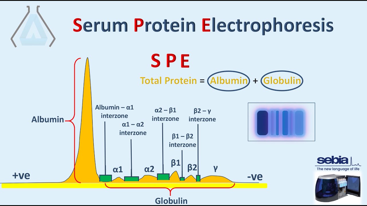 الترحيل الكهربائي للبروتينات   Protein Electrophoresis