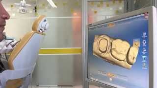 Como Manejar El Cerec Primera Parte Escaneo Y Diseño