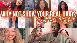 Why Don’t the “Exoticals” Ever Expose Their Real Hair |Psychoanalysis
