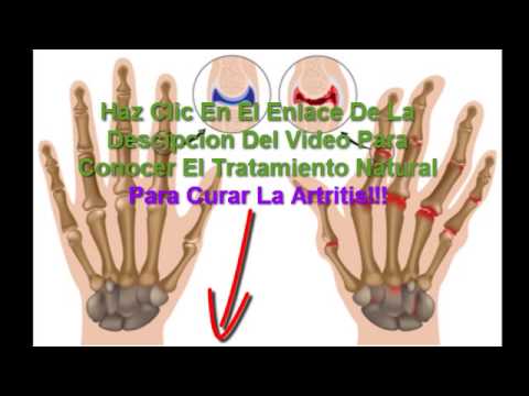 Los ejercicios para la columna vertebral a la osteocondrosis y boninoy