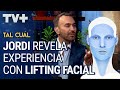 Jordi y su experiencia con un Lifting Facial