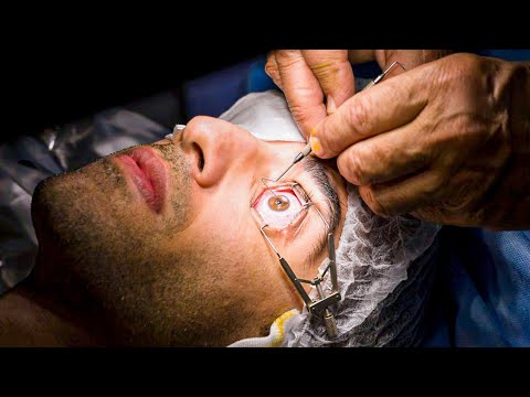 تعمل ايه قبل جراحة الليزك للعيون واثناء الجراحة وبعدها