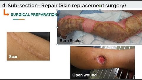 Integumentary system - Surgical preparation - Current Procedural Terminology