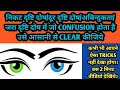 निकट दृष्टि दोष | दूर दृष्टि दोष | जरा दृष्टि दोष | अबिन्दुकता | Remove Confusion| Biology Tricks