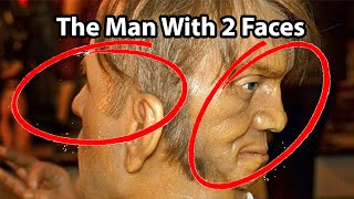 Celebrity The Man With 2 Faces | The Mysterious Story Of Edward Mordrake Net Worth