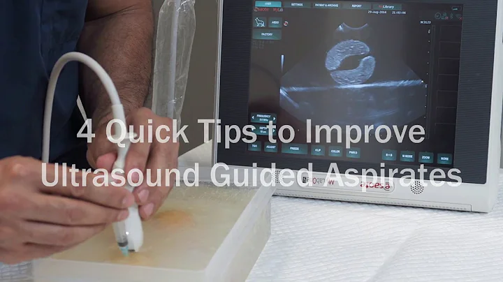 4 quick tips to improve ultrasound guided aspirates