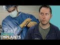 Meet The Doctor Who Wants To Put An Implant In Your Brain | Random Thursday