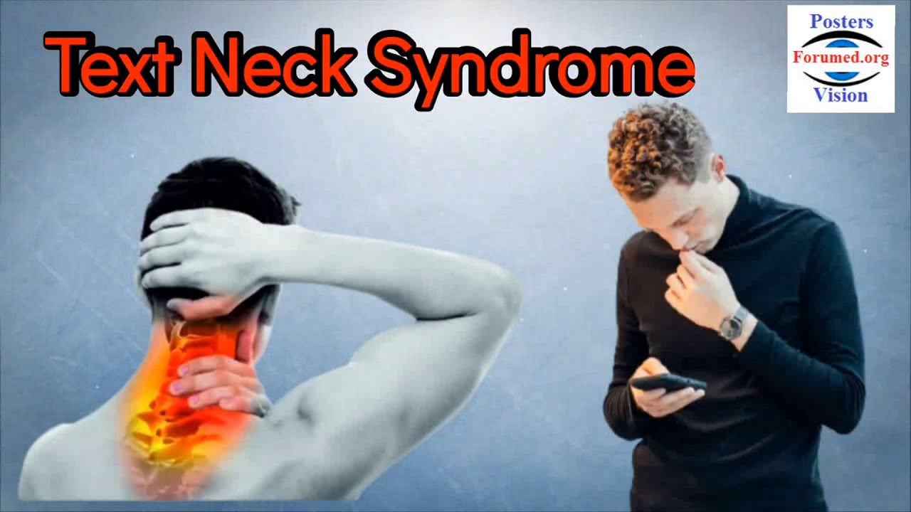 Syndrome de Text-Neck les signes cliniques Traitements et les exercices kiné du Torticolis