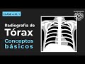 041  trax  radiografa de trax normal