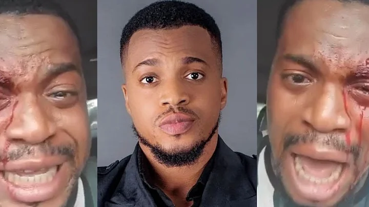 Actor Akeem Adeyemi attacked on movie set