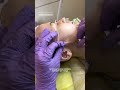 Лифтинг. Запись на все обучающие программы ➡️ inst:dr.antonina_guz