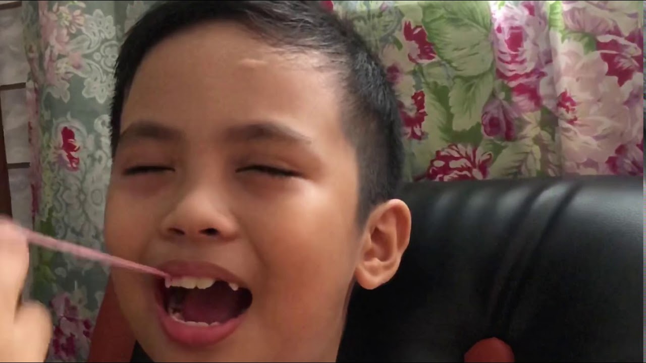 How to Pull Out a Loose Tooth