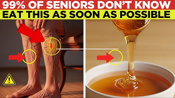 SENIORS, THESE 7 Foods Stop Leg Cramps in 90 Seconds (Doctors Won’t Tell You This!)