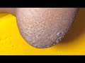 Satisfying Foot Spa | Soft and Clean Feet #fypシ #fypシ゚viralシ #toenailcare #hygieneservice