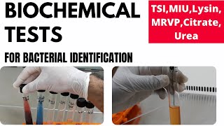 Biochemical Tests For Bacterial Identification Part-1Tsi, Miu, Mr-Vp, Lysin, Urea, Citrate