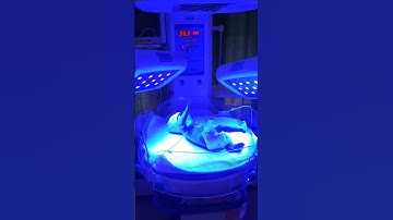 baby on phototherapy, bilirubin reduction by phototherapy#science #health #youtubeshorts #neet