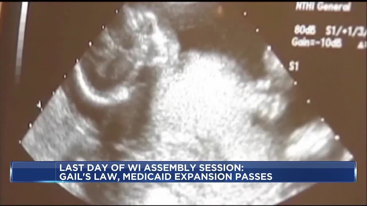 Wisconsin Assembly passes Gail’s Law, postpartum Medicaid expansion