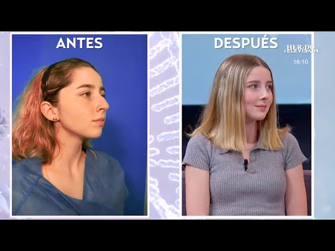 Video: Sofia Nikitchuk Habló Sobre La Experiencia De La Cirugía Plástica