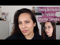 What I use for Glowing Skin | I have Seborrheic Dermatitis & Psoriasis