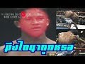 บัวขาวโกรธที่สุดในชีวิตการต่อย KickBoxing (Buakaw angry) HD