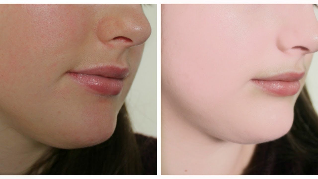 How To Clear Dark Spots On Face Naturally How To Clear Dark Spots On Face Naturally