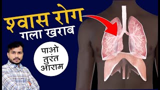 Shwas Rog Gala Kharab Sukhi Khansi Me Mulethi Ka Praayogik|| Respiratory Problems Use Liquorice