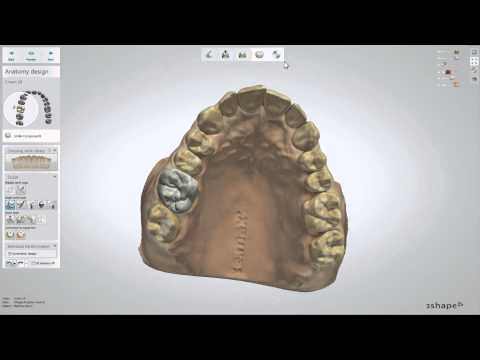 camera iphone 8 plus apk Dental Designer Benutzeroberfläche 2015