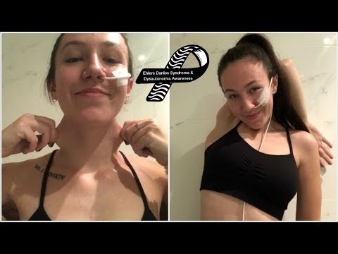 ♡ EDS Awareness 2018: My Journey to a Diagnosis! | Amy Lee Fisher ♡