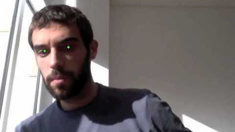 Eye center localization.