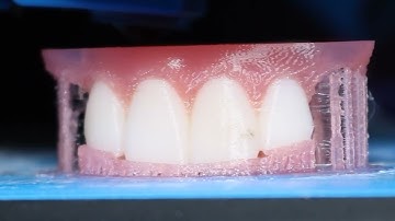 Impress3D - 3D Printed Valplast Flexible Partial Dentures