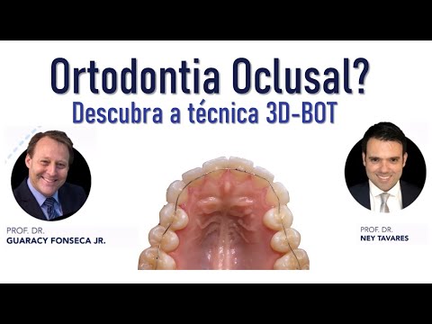 Ortodontia Oclusal  Descubra o 3D BOT (com os Profs. Guaracy Fonseca e Ney Tavares)