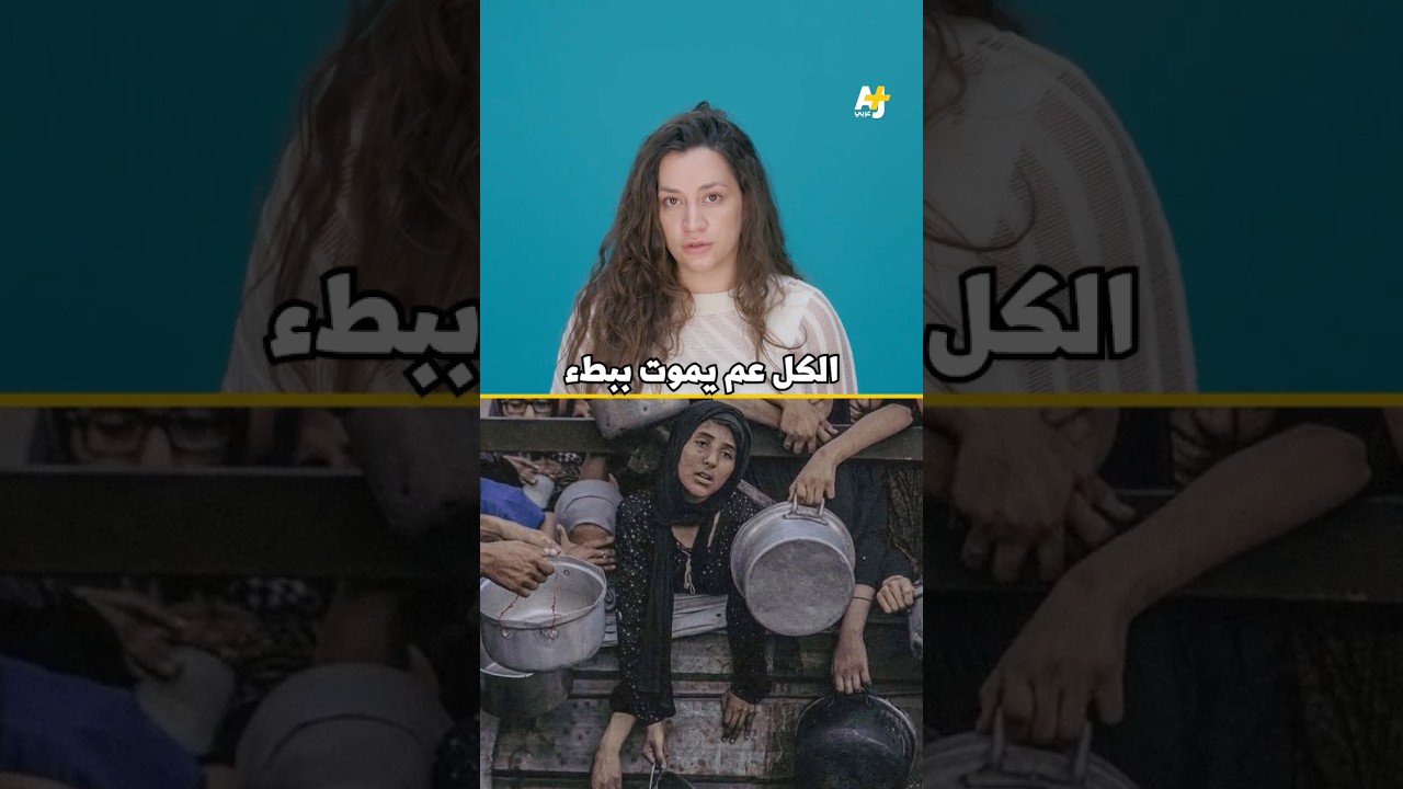 ضحايا التجويع