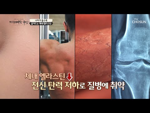 중년 여성들의 전신 탄력을 위한 【 엘라스틴 】 TV CHOSUN 20221110 방송 | [더 위대한 유산] 17회 | TV조선
