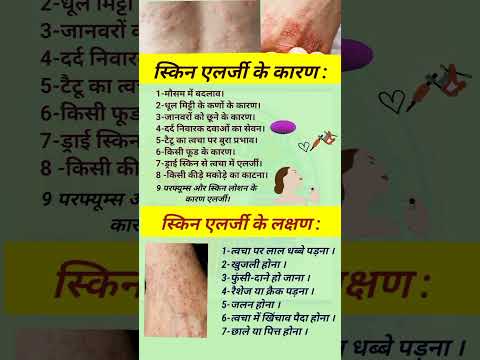 स क न एलर ज स क न एलर ज क क रण एव लक षण Healthytips Youtubeshorts Allergy