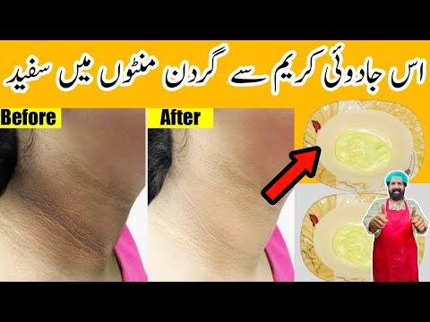 Neck Whitening Cream at Home | Get Rid of Drak Neck in 5 Minutes | Beauty Tips | BaBa Food RRC