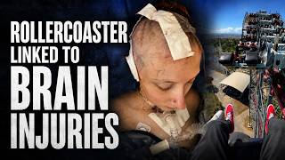 Six Flags rollercoaster linked to brain injuries